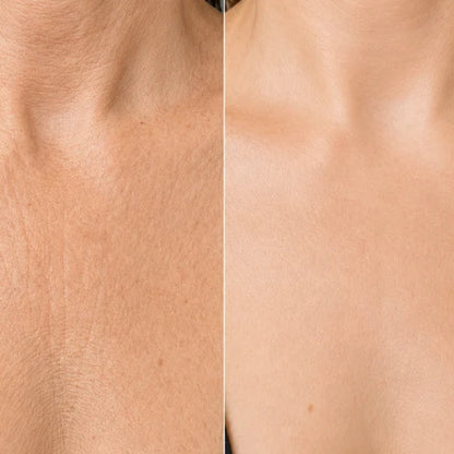 Collagen Chest Mask