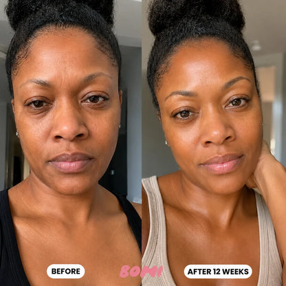 Salmon PDRN Collagen Mask