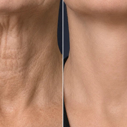 Collagen Neck Mask